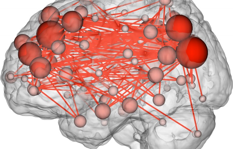 This image shows the functional connections in the brain that tend to be most discriminating of individuals. Many of them are between the frontal and parietal lobes, which are involved in complex cognitive tasks. Photo by Emily Finn