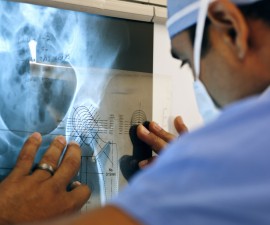 Measuring for implant during orthopedic surgery