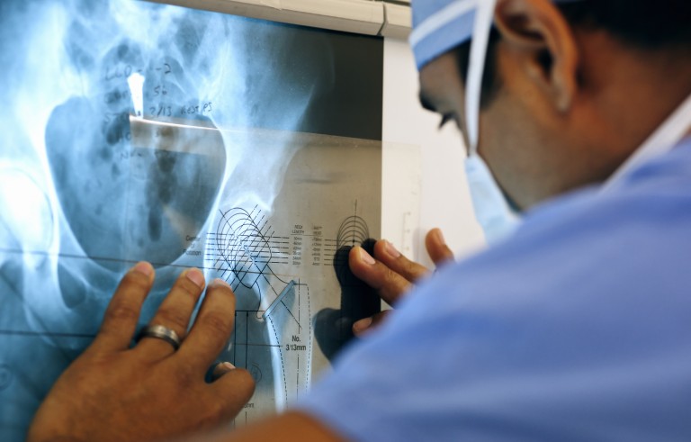 Measuring for implant during orthopedic surgery
