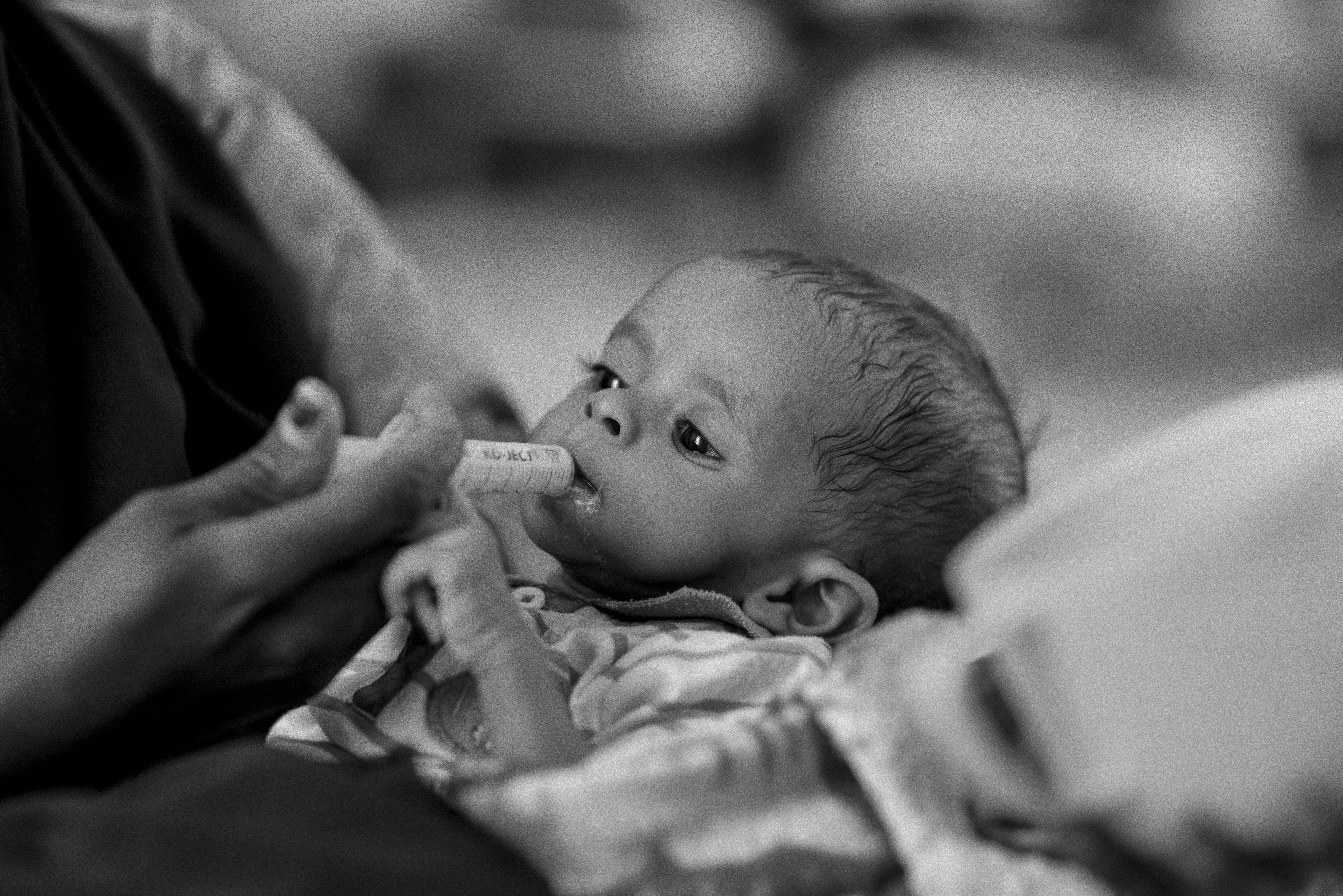 A malnourished child is fed with a syringe. Photo by Sebastian Rich for UNICEF