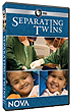 Separating Twins