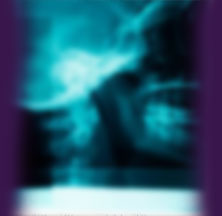SICK AOUND THE WORLD