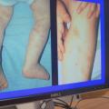 One Hospital’s New Plan to Catch Questionable Cases of Child Abuse