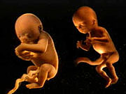 ape and human embryos