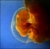 human embryo