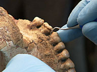 Spark Blog: Video: Ancient Dental Cleaning