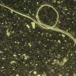 Nematode Worms