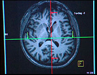 p_cover_brainimage