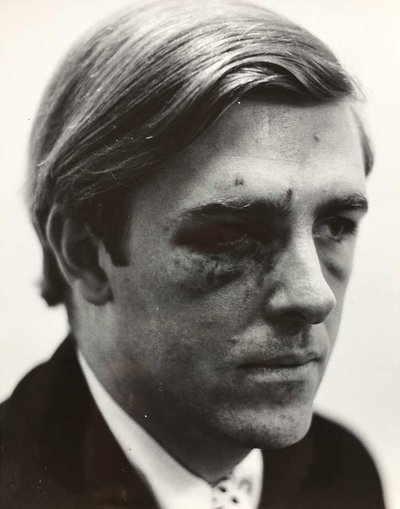 Michael Belknap post-riot. Photo courtesy of Michael Belknap. Michael-Belknap (1).jpg