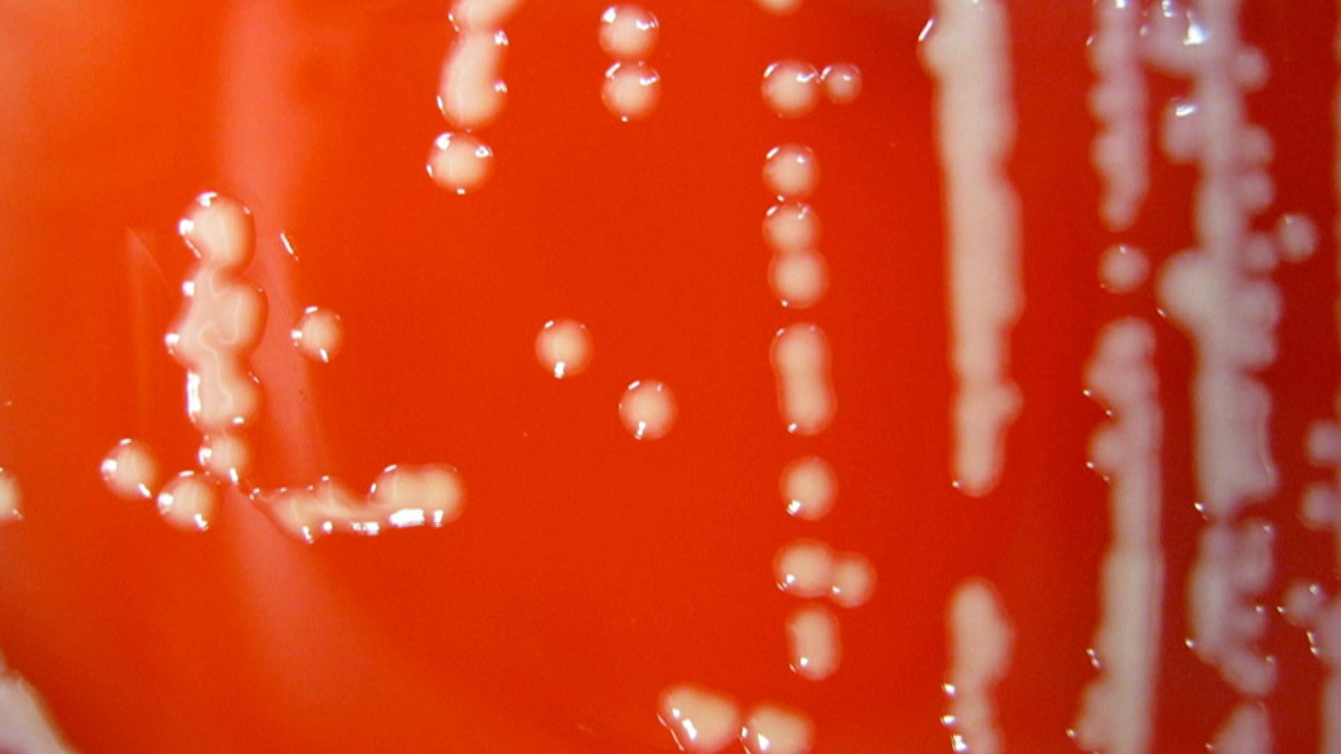 Florida Bill Would Combat Superbug Threat