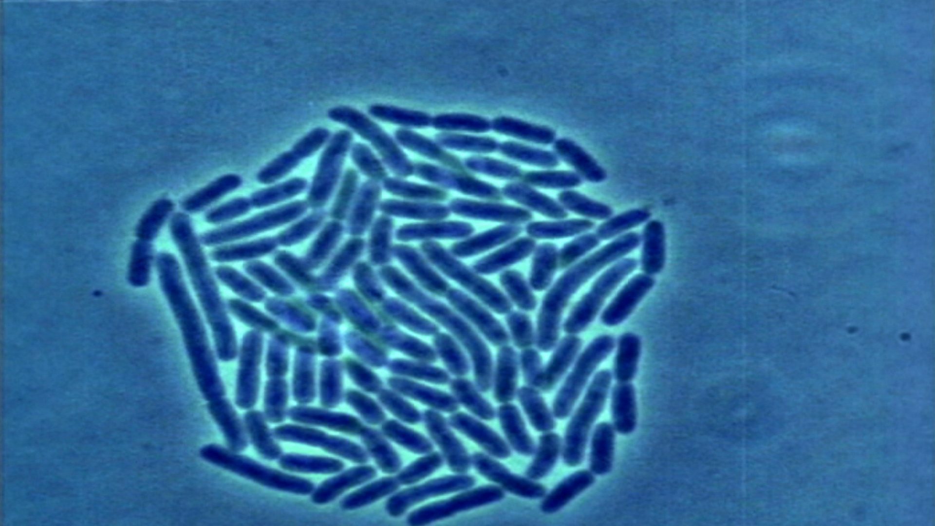 Illinois “Nightmare Bacteria” Outbreak Raises Alarms