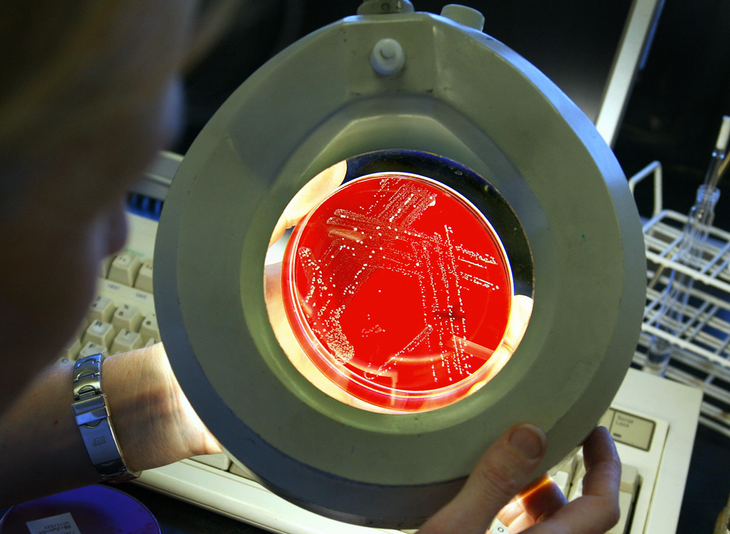 Big Pharma Calls for New Incentives to Fight “Superbugs”