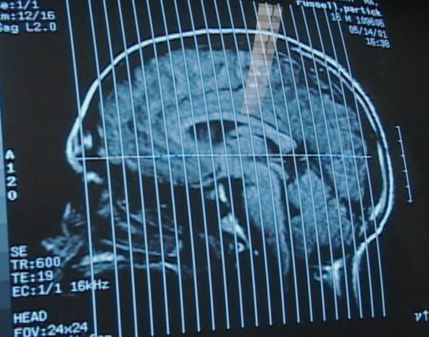 Inside the Teenage Brain | FRONTLINE | PBS | Official Site