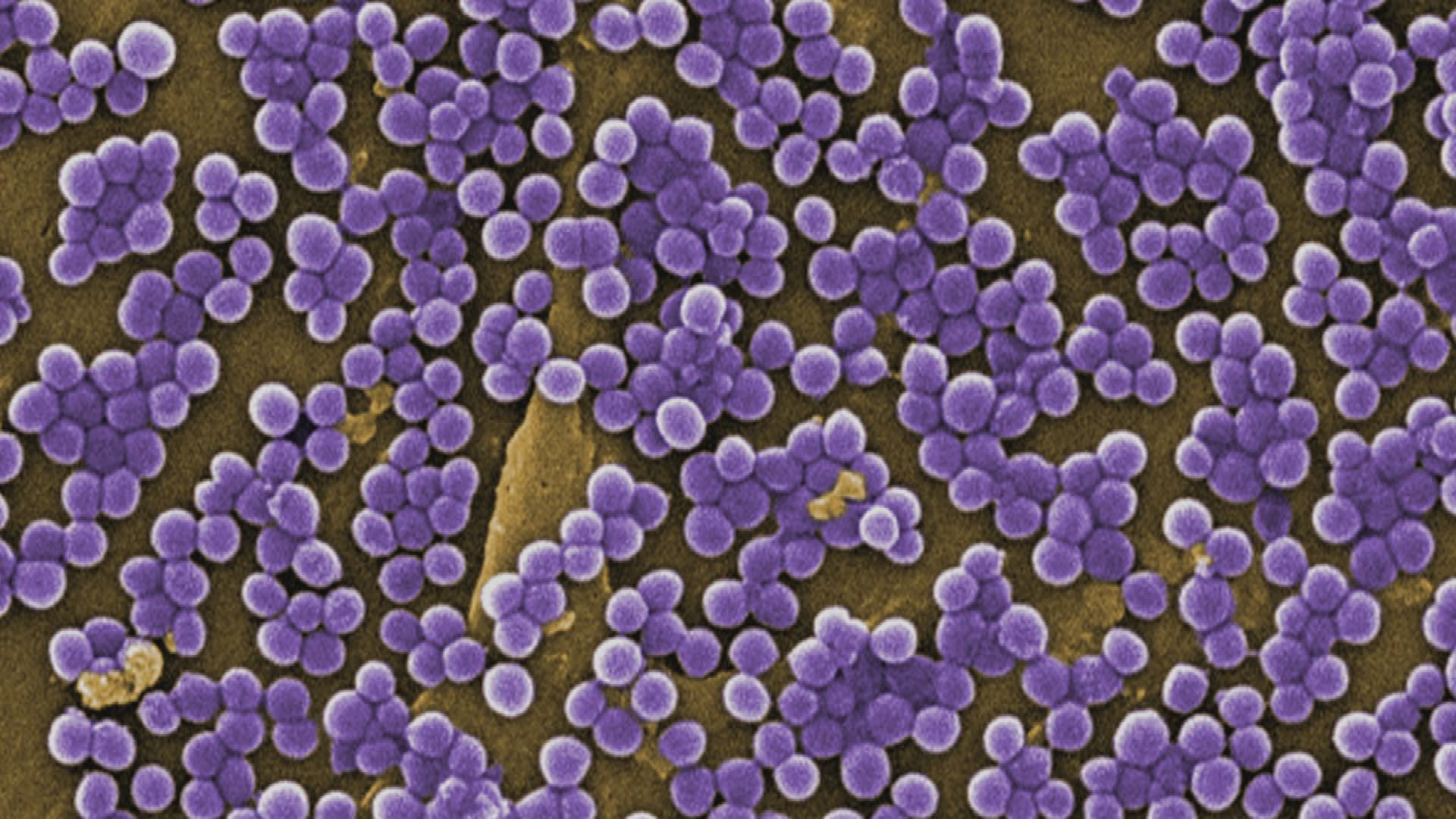 MRSA_micrograpes