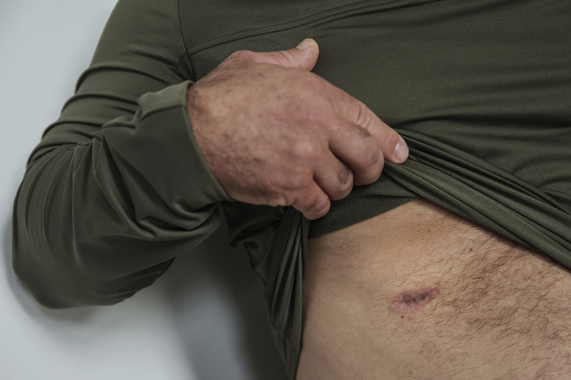Oleksii Dibrovskyi, a deputy of the Polohy City Council, in Zaporizhzhia region, shows a scar on his body in Krakow, Poland, Tuesday, Aug. 23, 2022. In a deliberate, widespread campaign, Russian forces systematically targeted influential Ukrainians like Dibrovskyi, nationally and locally, to neutralize resistance through detention, torture and executions, an Associated Press investigation has found. (AP Photo/Michal Dyjuk)