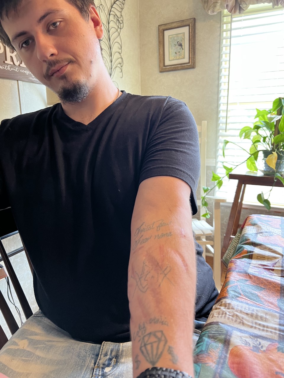 Anthony Muckenfuss showing his self-harm scars.