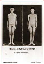 josef mengele as a child