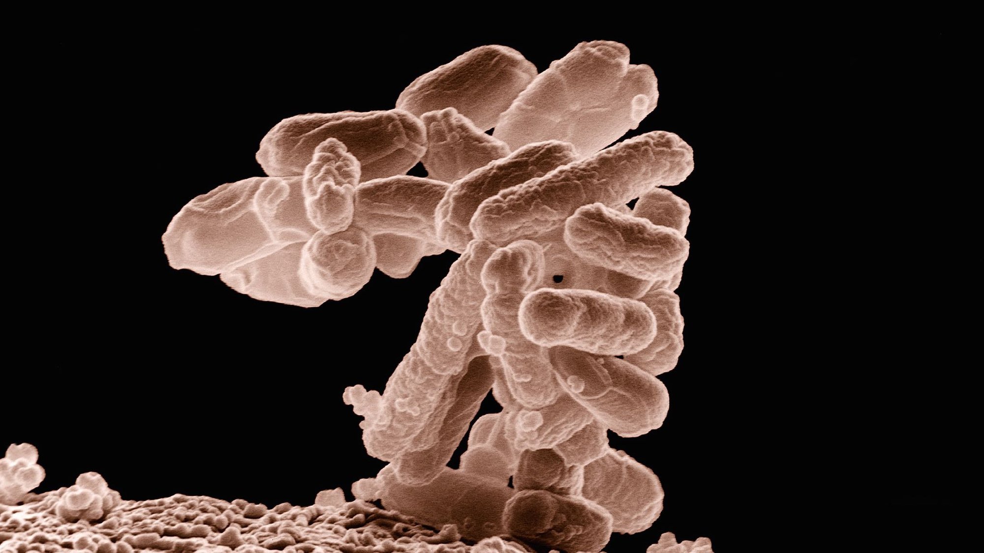 Engineered Virus Rids Bacteria of Antibiotic Resistance | NOVA | PBS