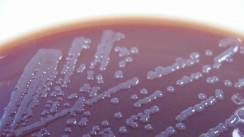 Rothia mucilaginosa culture