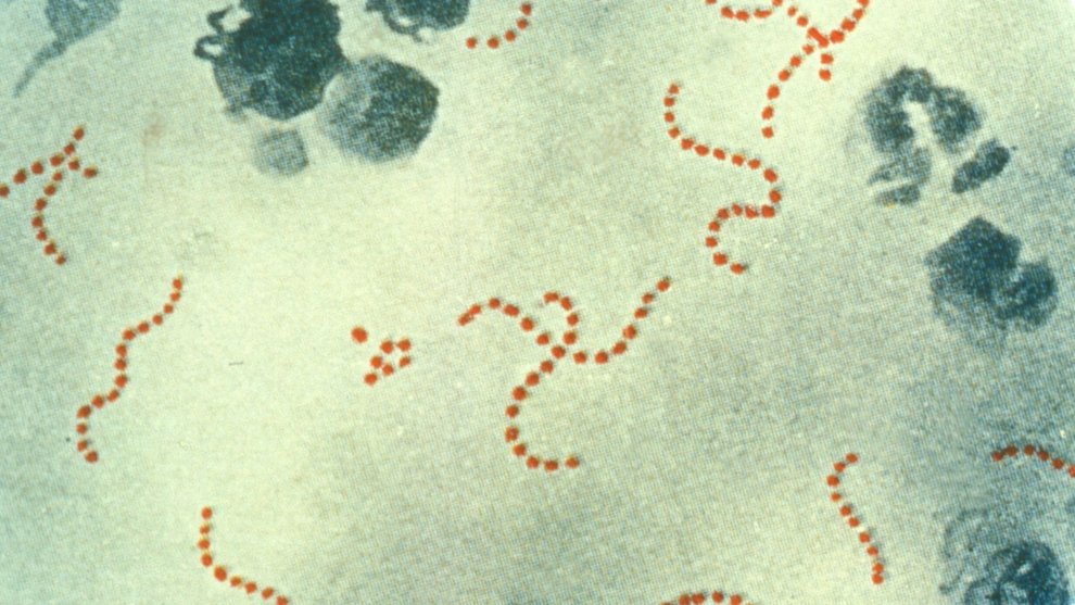 Streptococcus pyogenes