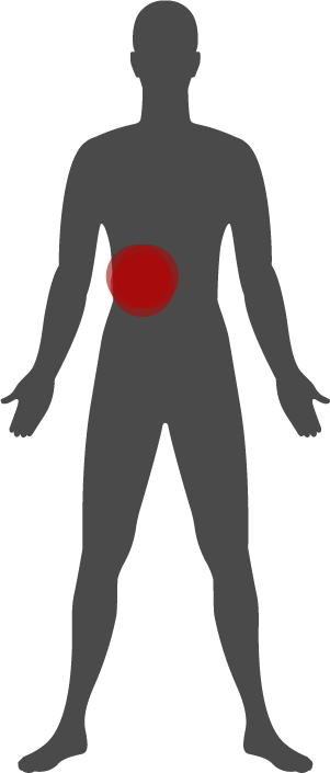 Untreated gallbladder infection