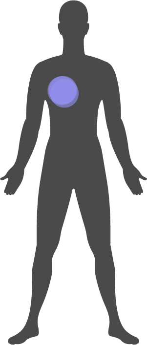 Sponge left inside breast