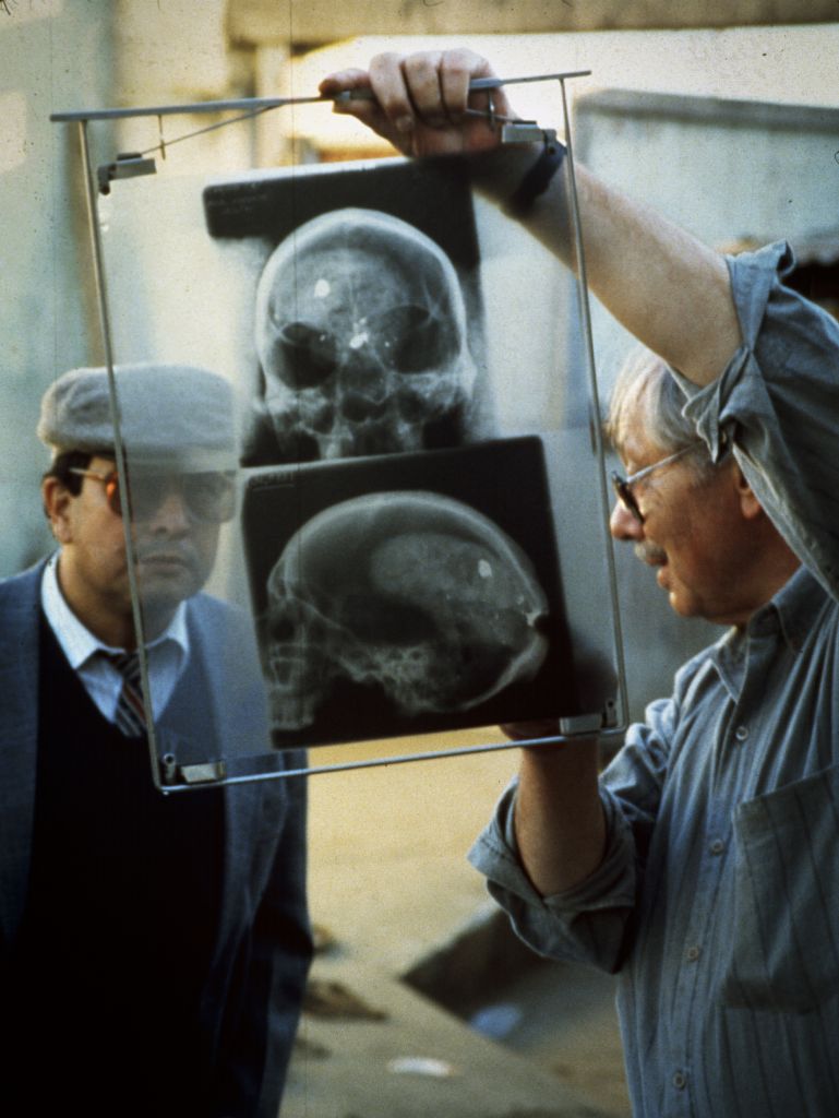 Forensic anthropologist Dr. Clyde Snow identifies bullet fragments in an skull x-ray of a victim abducted and executed by the military in the 1990s. Credit: Eric Stover