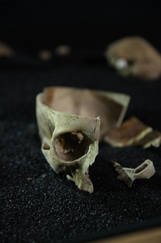 Close up of the actual bones discovered in the basement of Craven Street. 