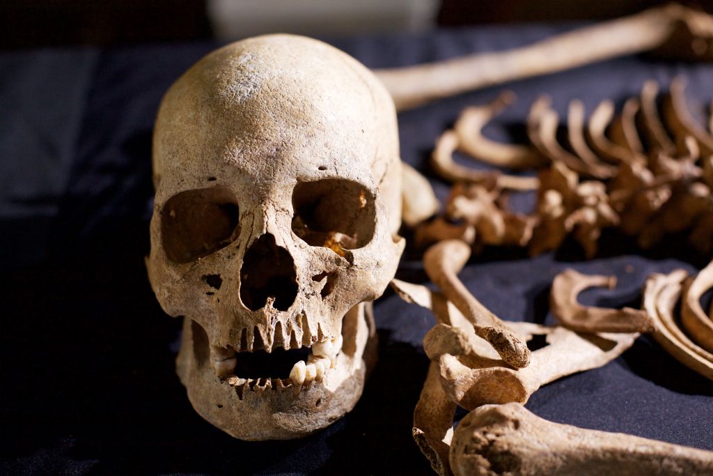 Female skull from deviant burial at Anglo-Saxon site - West Heslerton, Workshire, England.